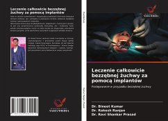 Leczenie ca¿kowicie bezz¿bnej ¿uchwy za pomoc¿ implantów - Kumar, Bineet; Ranjan, Rakesh; Prasad, Ravi Shankar