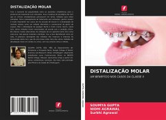 DISTALIZAÇÃO MOLAR - Gupta, Soumya; Agrawal, Nidhi; Agrawal, Surbhi