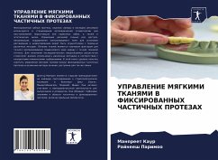 Cover UPRAVLENIE MYaGKIMI TKANYaMI V FIKSIROVANNYH ChASTIChNYH PROTEZAH