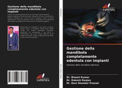 Gestione della mandibola completamente edentula con impianti - Kumar, Bineet; Ranjan, Rakesh; Prasad, Ravi Shankar