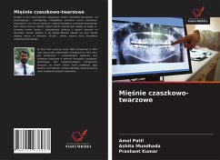 Mi¿¿nie czaszkowo-twarzowe - Patil, Amol; Mundhada, Ashita; Kumar, Prashant