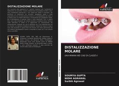 DISTALIZZAZIONE MOLARE - Gupta, Soumya; Agrawal, Nidhi; Agrawal, Surbhi