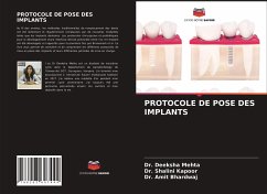 PROTOCOLE DE POSE DES IMPLANTS - Mehta, Deeksha; Kapoor, Shalini; Bhardwaj, Amit