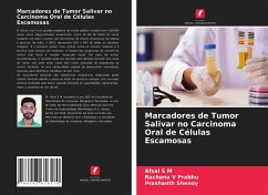 Marcadores de Tumor Salivar no Carcinoma Oral de Células Escamosas - S M, Afsal; V Prabhu, Rachana; Shenoy, Prashanth