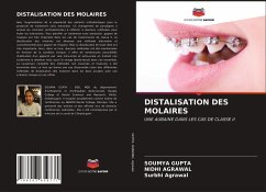 DISTALISATION DES MOLAIRES - Gupta, Soumya; Agrawal, Nidhi; Agrawal, Surbhi