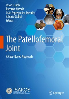 The Patellofemoral Joint