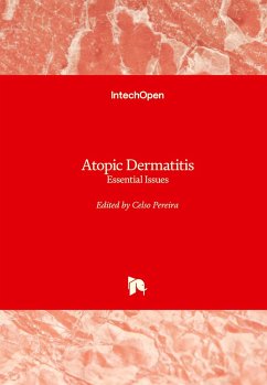 Atopic Dermatitis