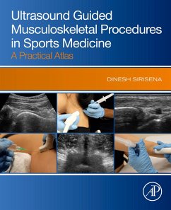Cover Ultrasound Guided Musculoskeletal Procedures in Sports Medicine (eBook, ePUB)