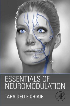 Essentials of Neuromodulation (eBook, ePUB) - Chiaie, Tara Delle