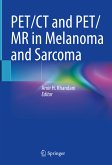 PET/CT and PET/MR in Melanoma and Sarcoma (eBook, PDF)