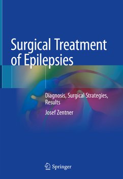 Surgical Treatment of Epilepsies (eBook, PDF) - Zentner, Josef