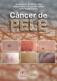 Câncer de pele (eBook, ePUB) Câncer de pele (eBook, ePUB)