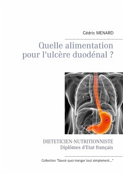 Quelle alimentation pour l'ulcère duodénal ? (eBook, ePUB) - Menard, Cédric