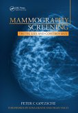 Mammography Screening (eBook, ePUB)