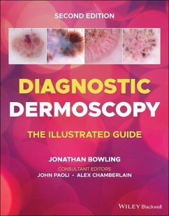 Diagnostic Dermoscopy - Diagnostic Dermoscopy