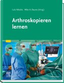 Arthroskopieren lernen (eBook, ePUB)