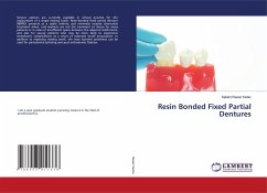 Resin Bonded Fixed Partial Dentures