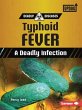 Typhoid Fever - Bild 1