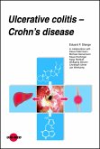 Ulcerative colitis - Crohn’s disease (eBook, PDF)