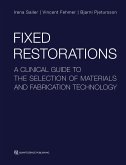 Fixed Restorations (eBook, ePUB)