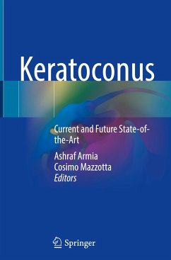 Keratoconus