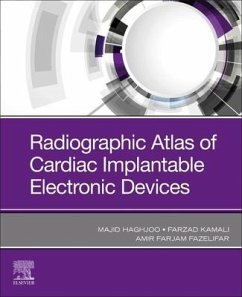 Radiographic Atlas of Cardiac Implantable Electronic Devices - HAGHJOO, MAJID