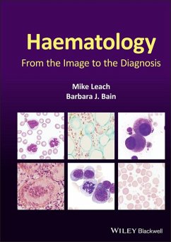 Haematology (eBook, ePUB) - Leach, Mike; Bain, Barbara J.