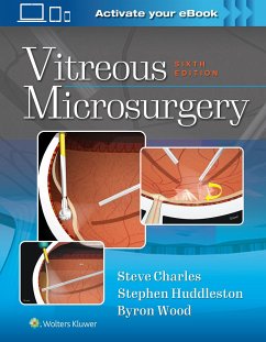 Vitreous Microsurgery - Charles, Steve