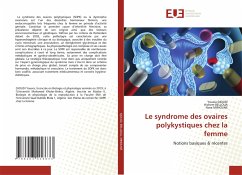 Le syndrome des ovaires polykystiques chez la femme - DJOUDI, Yousra;BELLOUA, Hichem;MIMOUNE, Nora