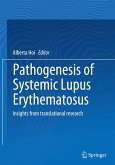 Pathogenesis of Systemic Lupus Erythematosus