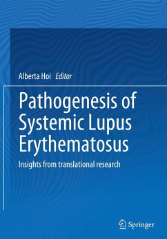 Pathogenesis of Systemic Lupus Erythematosus