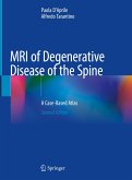 MRI of Degenerative Disease of the Spine (eBook, PDF)