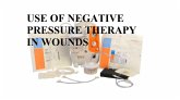 USE OF NEGATIVE PRESSURE THERAPY IN WOUNDS (eBook, ePUB) USE OF NEGATIVE PRESSURE THERAPY IN WOUNDS (eBook, ePUB)