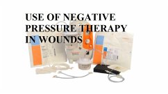 Cover USE OF NEGATIVE PRESSURE THERAPY IN WOUNDS (eBook, ePUB)