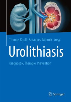 Urolithiasis (eBook, PDF)