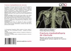 Fractura mediodiafisaria de clavícula