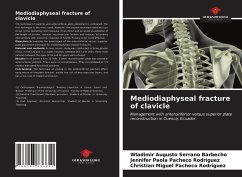 Mediodiaphyseal fracture of clavicle - Serrano Barbecho, Wladimir Augusto;Pacheco Rodríguez, Jennifer Paola;Pacheco Rodríguez, Christian Miguel