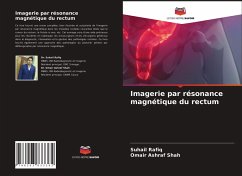 Imagerie par résonance magnétique du rectum - Rafiq, Suhail;Shah, Omair Ashraf