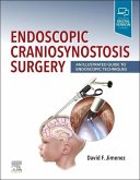 Endoscopic Craniosynostosis Surgery