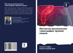 Magnitno-rezonansnaq tomografiq prqmoj kishki - Rafiq, Suhail;Shah, Omair Ashraf