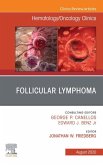 Follicular Lymphoma, An Issue of Hematology/Oncology Clinics of North America (eBook, ePUB)