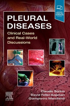 Cover Pleural Diseases,E-Book (eBook, ePUB)