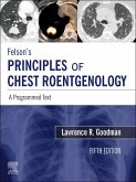 Felson's Principles of Chest Roentgenology E-Book (eBook, ePUB)