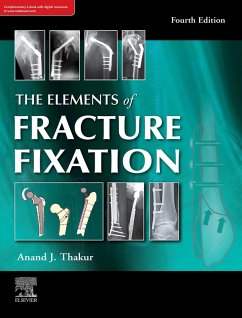 The elements of fracture fixation, 4e (eBook, ePUB) - Thakur MS(Ortho), Fcps