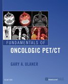 Fundamentals of Oncologic PET/CT E-Book (eBook, ePUB)