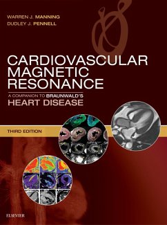 Cardiovascular Magnetic Resonance (eBook, ePUB) - Manning, Warren J.; Pennell, Dudley J.