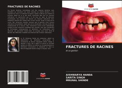 FRACTURES DE RACINES - HANDA, AISHWARYA;Singh, Sarita;SHINDE, Mrunal