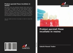 Protesi parziali fisse incollate in resina - Rawal Yadav, Sakshi