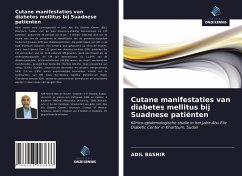 Cutane manifestaties van diabetes mellitus bij Suadnese patiënten - Bashir, Adil