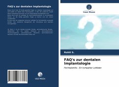 FAQ's zur dentalen Implantologie - S., Rohit